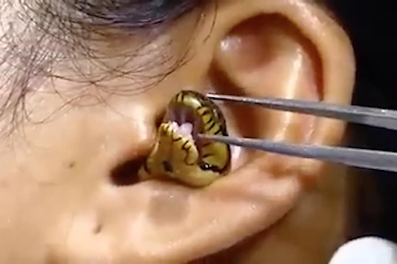 Live snake stuck in woman's ear in bizarre viral video